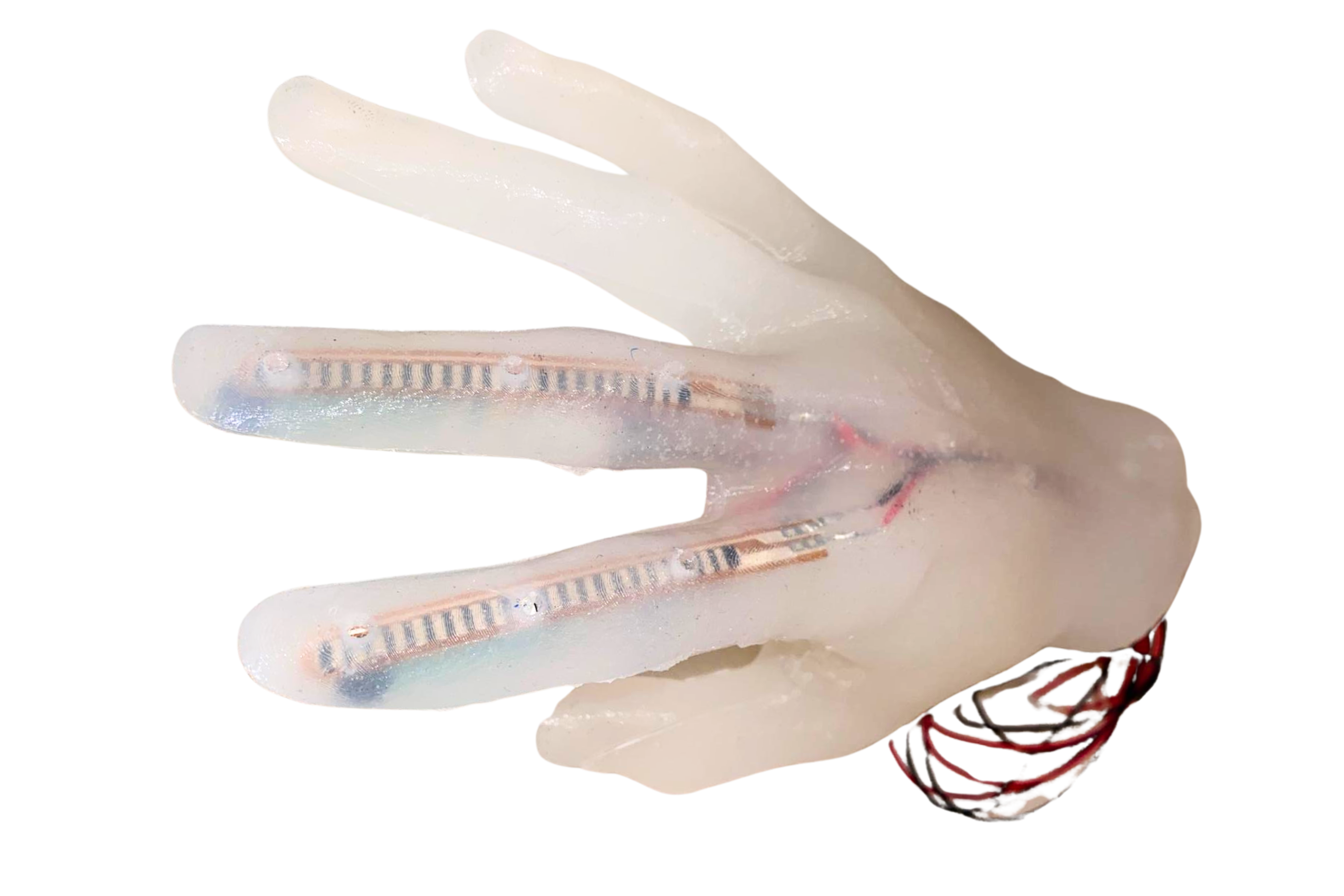 Armprothese mit integrierten Biegesensoren