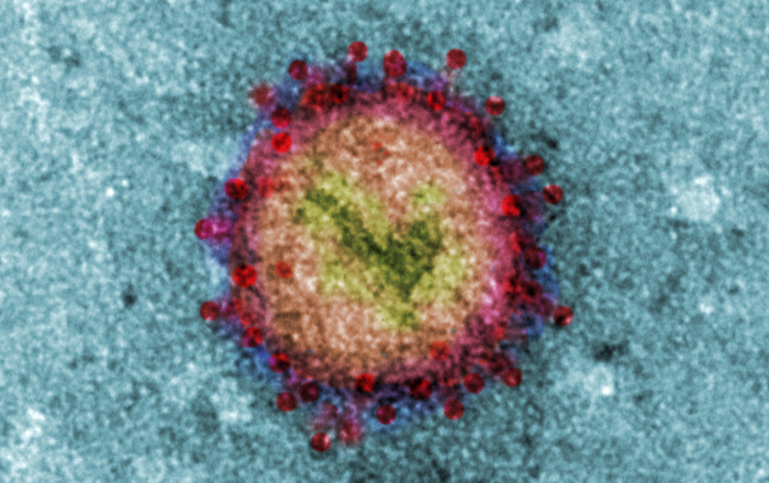 virus