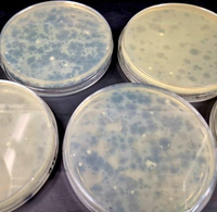 Bakterien wurden von spreziellen Viren infiziert und zerstört 